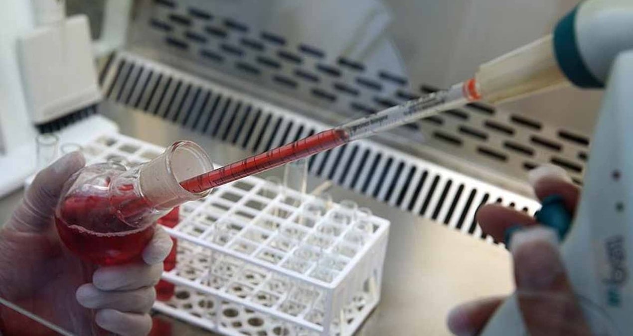 dunyada sadece 43 kiside var hem paha bicilemez bir hazine hem de buyuk bir risk altin kan CTiNO1rO